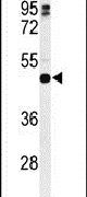 HLA-DRB5 Antibody in Western Blot (WB)