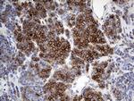 HLA Antibody in Immunohistochemistry (Paraffin) (IHC (P))