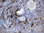 HLA Antibody in Immunohistochemistry (Paraffin) (IHC (P))