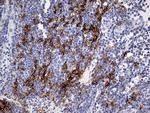 HLA Antibody in Immunohistochemistry (Paraffin) (IHC (P))