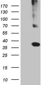 HLA Antibody in Western Blot (WB)