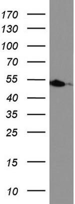 HMBS Antibody in Western Blot (WB)