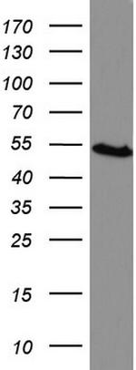 HMBS Antibody in Western Blot (WB)