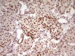 HMG20A Antibody in Immunohistochemistry (Paraffin) (IHC (P))