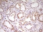 HMG20A Antibody in Immunohistochemistry (Paraffin) (IHC (P))