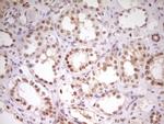 HMG20A Antibody in Immunohistochemistry (Paraffin) (IHC (P))