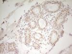 HMG20A Antibody in Immunohistochemistry (Paraffin) (IHC (P))