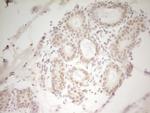 HMG20A Antibody in Immunohistochemistry (Paraffin) (IHC (P))