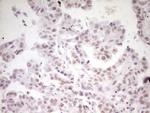 HMG20A Antibody in Immunohistochemistry (Paraffin) (IHC (P))