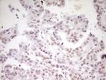 HMG20A Antibody in Immunohistochemistry (Paraffin) (IHC (P))