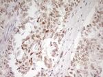 HMG20A Antibody in Immunohistochemistry (Paraffin) (IHC (P))