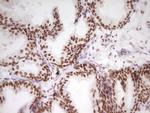 HMG20A Antibody in Immunohistochemistry (Paraffin) (IHC (P))