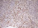 HMG20A Antibody in Immunohistochemistry (Paraffin) (IHC (P))