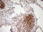 HMG20A Antibody in Immunohistochemistry (Paraffin) (IHC (P))