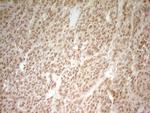 HMG20A Antibody in Immunohistochemistry (Paraffin) (IHC (P))