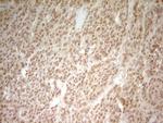 HMG20A Antibody in Immunohistochemistry (Paraffin) (IHC (P))