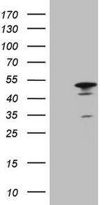 HMG20A Antibody in Western Blot (WB)