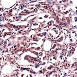 HMGA2 Antibody in Immunohistochemistry (IHC)