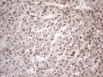 HMGB4 Antibody in Immunohistochemistry (Paraffin) (IHC (P))
