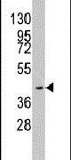 MYST1 Antibody in Western Blot (WB)