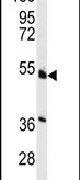 HNF4A Antibody in Western Blot (WB)