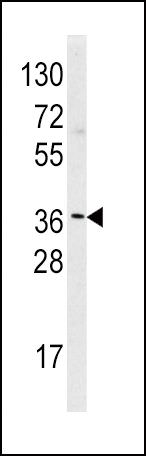 HNMT Antibody in Western Blot (WB)