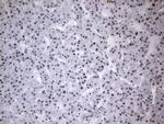 HNRNPA0 Antibody in Immunohistochemistry (Paraffin) (IHC (P))