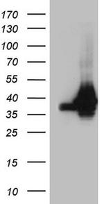 HNRNPA0 Antibody in Western Blot (WB)