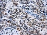 HNRNPF Antibody in Immunohistochemistry (Paraffin) (IHC (P))
