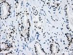 HNRNPF Antibody in Immunohistochemistry (Paraffin) (IHC (P))