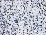 HNRNPF Antibody in Immunohistochemistry (Paraffin) (IHC (P))