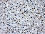 HNRNPF Antibody in Immunohistochemistry (Paraffin) (IHC (P))