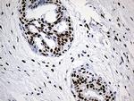 HNRNPH1 Antibody in Immunohistochemistry (Paraffin) (IHC (P))
