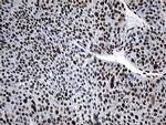 HNRNPH1 Antibody in Immunohistochemistry (Paraffin) (IHC (P))