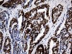 HNRNPH1 Antibody in Immunohistochemistry (Paraffin) (IHC (P))
