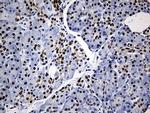 HNRNPH1 Antibody in Immunohistochemistry (Paraffin) (IHC (P))