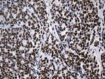 HNRNPH1 Antibody in Immunohistochemistry (Paraffin) (IHC (P))