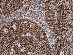HNRNPH1 Antibody in Immunohistochemistry (Paraffin) (IHC (P))