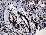 HNRNPH1 Antibody in Immunohistochemistry (Paraffin) (IHC (P))