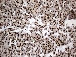 HNRNPH1 Antibody in Immunohistochemistry (Paraffin) (IHC (P))