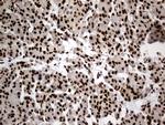HNRNPH1 Antibody in Immunohistochemistry (Paraffin) (IHC (P))