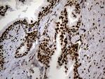 HNRNPH1 Antibody in Immunohistochemistry (Paraffin) (IHC (P))