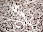 HNRNPH1 Antibody in Immunohistochemistry (Paraffin) (IHC (P))