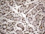 HNRNPH1 Antibody in Immunohistochemistry (Paraffin) (IHC (P))