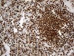 HNRNPH1 Antibody in Immunohistochemistry (Paraffin) (IHC (P))