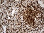HNRNPH1 Antibody in Immunohistochemistry (Paraffin) (IHC (P))