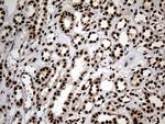 HNRNPH1 Antibody in Immunohistochemistry (Paraffin) (IHC (P))