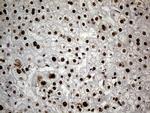 HNRNPH1 Antibody in Immunohistochemistry (Paraffin) (IHC (P))