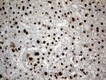 HNRNPH1 Antibody in Immunohistochemistry (Paraffin) (IHC (P))