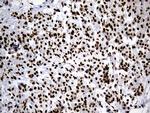 HNRNPH1 Antibody in Immunohistochemistry (Paraffin) (IHC (P))